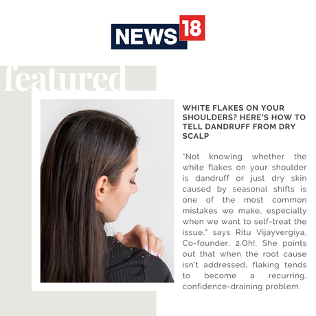 White Flakes On Your Shoulders? Here’s How To Tell Dandruff From Dry Scalp